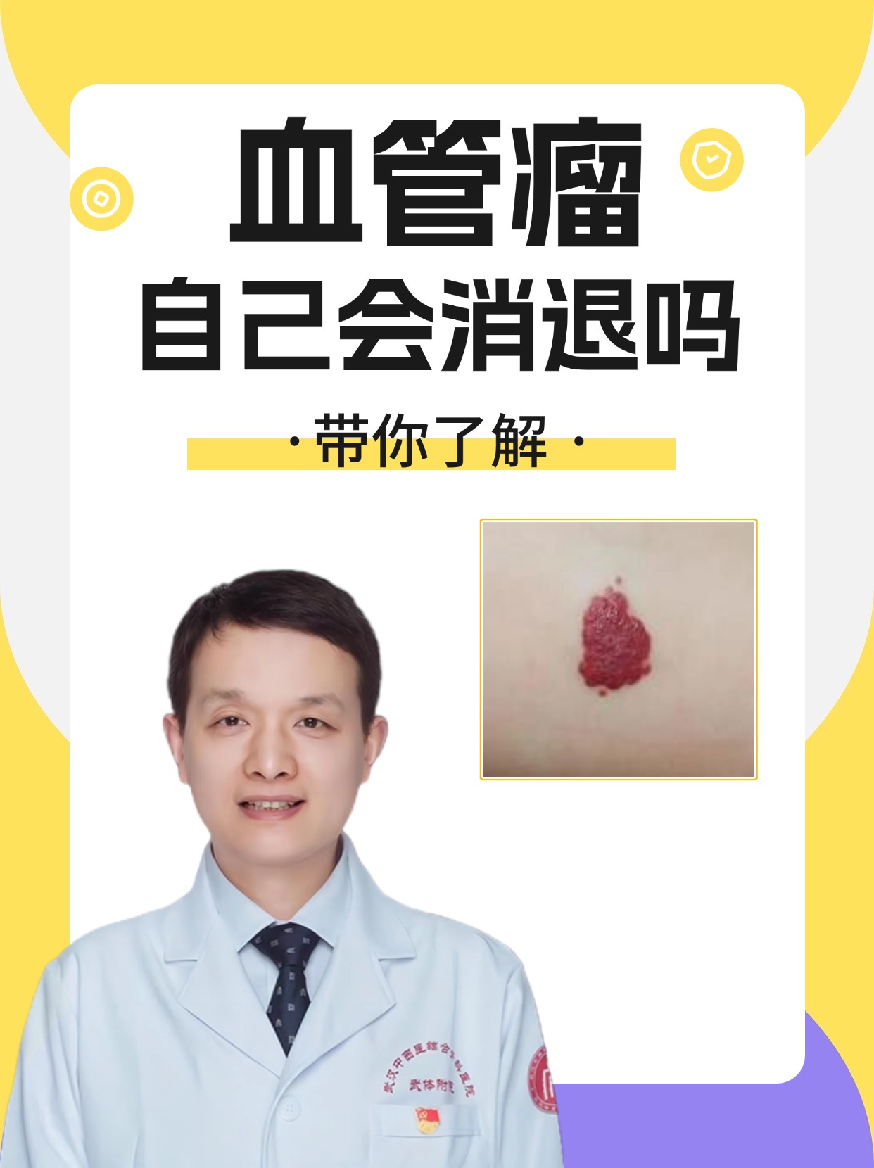 阿里健康首发：婴儿血管瘤外用原研药贝美净®马来酸噻吗洛尔凝胶