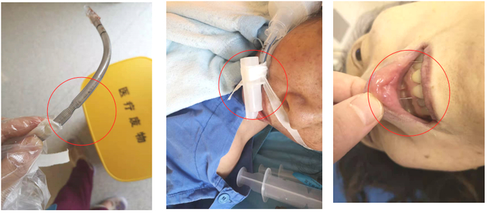 联影医疗获得实用新型专利授权：“物料缓存桌”