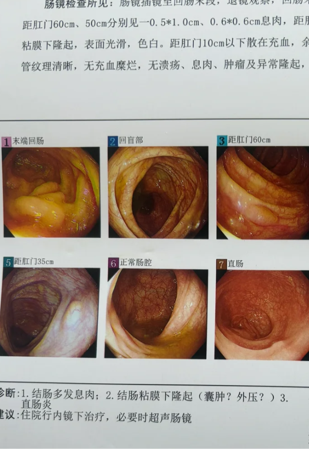 上海医药获得发明专利授权:“治疗炎性肠病的方法”